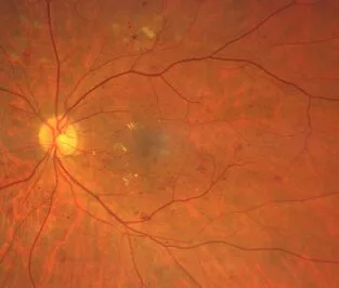 Ein Bild eines menschlichen Auges mit roter und oranger Farbe.