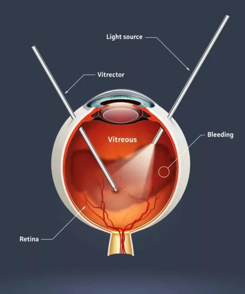 Ein Diagramm, das die Anatomie des Auges zeigt.